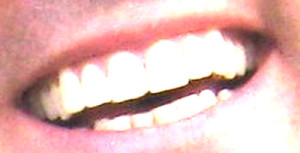 CoryGardner-Teeth